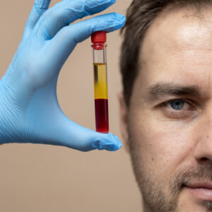 Platelet-rich plasma (PRP)