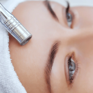 Microdermabrasion Treatment + Hidratation