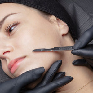 Dermaplaning